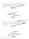 Fig. 18 - BALLOON CATHETER WITH INTEGRATED STOP FEATURE FOR PRECISE STENT PLACEMENT, FOR OSTIAL, RENAL AND OTHER LOCATIONS