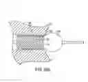 Fig. 32 - BALLOON CATHETER WITH INTEGRATED STOP FEATURE FOR PRECISE STENT PLACEMENT, FOR OSTIAL, RENAL AND OTHER LOCATIONS