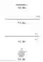 Fig. 48 - BALLOON CATHETER WITH INTEGRATED STOP FEATURE FOR PRECISE STENT PLACEMENT, FOR OSTIAL, RENAL AND OTHER LOCATIONS