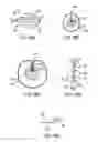 Fig. 53 - BALLOON CATHETER WITH INTEGRATED STOP FEATURE FOR PRECISE STENT PLACEMENT, FOR OSTIAL, RENAL AND OTHER LOCATIONS