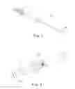 Fig. 02 - Delivery systems and methods of implantation for prosthetic heart valves