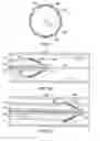 Fig. 03 - Medical devices and related methods