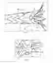 Fig. 05 - Endoluminal prosthesis comprising a valve replacement and at least one fenestration