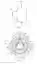 Fig. 06 - Endoluminal prosthesis comprising a valve replacement and at least one fenestration