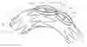 Fig. 01 - Thoracic stent graft with guide arrangement