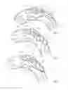 Fig. 02 - Thoracic stent graft with guide arrangement