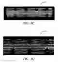 Fig. 08 - Implantable and lumen-supporting stents and related methods of manufacture and use