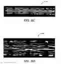 Fig. 11 - Implantable and lumen-supporting stents and related methods of manufacture and use