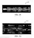 Fig. 13 - Implantable and lumen-supporting stents and related methods of manufacture and use