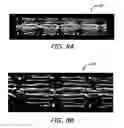 Fig. 14 - Implantable and lumen-supporting stents and related methods of manufacture and use