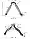 Fig. 15 - Implantable and lumen-supporting stents and related methods of manufacture and use