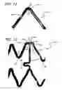 Fig. 16 - Implantable and lumen-supporting stents and related methods of manufacture and use