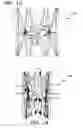 Fig. 17 - Implantable and lumen-supporting stents and related methods of manufacture and use