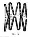 Fig. 18 - Implantable and lumen-supporting stents and related methods of manufacture and use