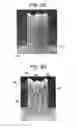 Fig. 10 - Stent-Valves for Valve Replacement and Associated Methods and Systems for Surgery