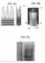 Fig. 13 - Stent-Valves for Valve Replacement and Associated Methods and Systems for Surgery