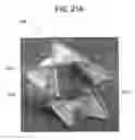 Fig. 17 - Stent-Valves for Valve Replacement and Associated Methods and Systems for Surgery