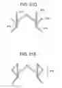 Fig. 19 - Stent-Valves for Valve Replacement and Associated Methods and Systems for Surgery