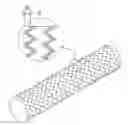 Fig. 01 - STENT WITH INTERNAL FORCE AND FABRICATION METHOD THEREOF
