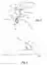 Fig. 02 - Device and Method for Modifying the Shape of a Body Organ