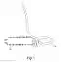 Fig. 07 - Device and Method for Modifying the Shape of a Body Organ