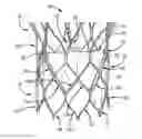 Fig. 01 - Leaflet suturing to commissure points for prosthetic heart valve