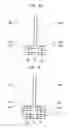 Fig. 07 - Leaflet suturing to commissure points for prosthetic heart valve