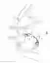 Fig. 02 - Adjustable annuloplasty ring with subcutaneous activation port