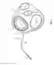 Fig. 03 - Adjustable annuloplasty ring with subcutaneous activation port