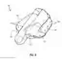 Fig. 06 - Adjustable annuloplasty ring with subcutaneous activation port