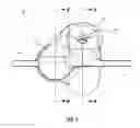 Fig. 08 - Adjustable annuloplasty ring with subcutaneous activation port
