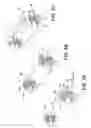 Fig. 04 - Structural/biological implant system