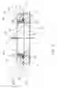 Fig. 06 - VERTEBRAL IMPLANT END CAP