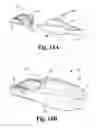 Fig. 22 - INTERBODY SPINAL IMPLANTS WITH MODULAR ADD-ON DEVICES