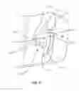 Fig. 07 - INTERVERTEBRAL IMPLANT WITH ROTATING MEMBER