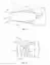 Fig. 14 - INTERVERTEBRAL IMPLANT WITH ROTATING MEMBER