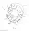 Fig. 04 - Expandable medical implant