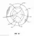 Fig. 10 - Expandable medical implant