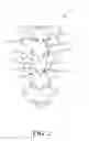 Fig. 03 - INTERVERTEBRAL IMPLANT