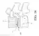 Fig. 17 - INTERVERTEBRAL IMPLANT