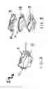 Fig. 03 - Anterior prosthetic spinal disc replacement