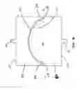 Fig. 06 - Anterior prosthetic spinal disc replacement