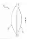 Fig. 10 - Anterior prosthetic spinal disc replacement