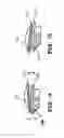 Fig. 12 - Anterior prosthetic spinal disc replacement