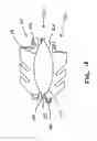 Fig. 15 - Anterior prosthetic spinal disc replacement