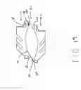 Fig. 16 - Anterior prosthetic spinal disc replacement