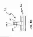 Fig. 20 - Anterior prosthetic spinal disc replacement