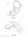 Fig. 17 - Joint Arthroplasty Devices