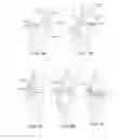 Fig. 26 - Joint Arthroplasty Devices