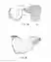 Fig. 31 - Joint Arthroplasty Devices